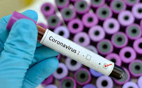 Новость - События - Хватит на 950 человек: Украине передали тест-системы для определения коронавируса