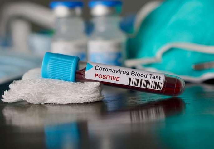 Новость - События - Пандемия коронавируса: в Украине заразились еще двое человек