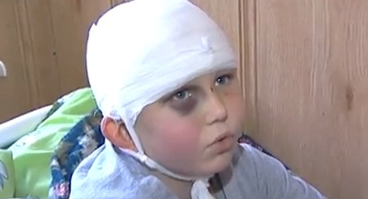 Старшеклассник проломил ребенку череп. Фото: скриншот из видео 
