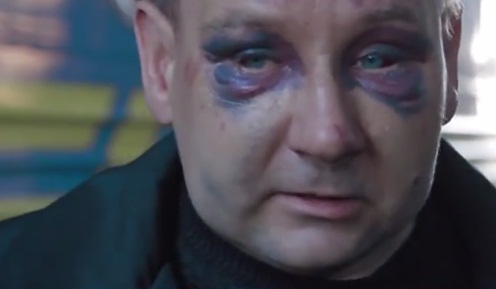 Сейчас избитый шахтер направлен в Киев на лечение. Принт скрин видео.